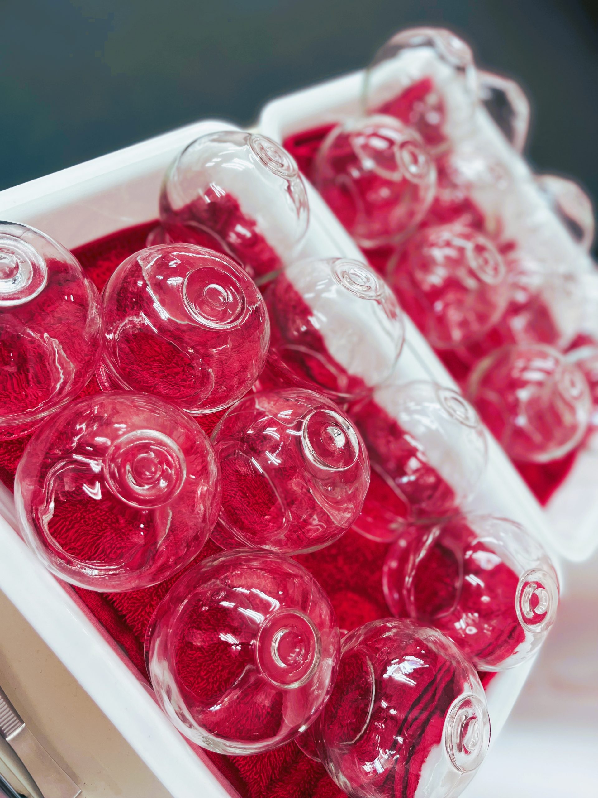 吸い玉（カッピング）